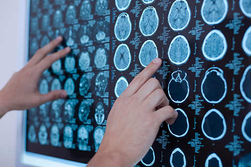 X ray images of human brain being put on the whiteboard X ray images of human brain being put on the whiteboard